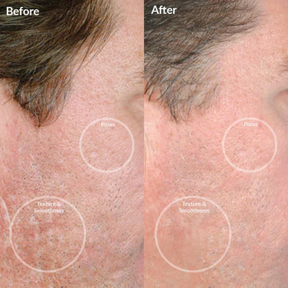 PMD Personal Microderm Pro - Black by PMD Beauty - Clearance (View 4)